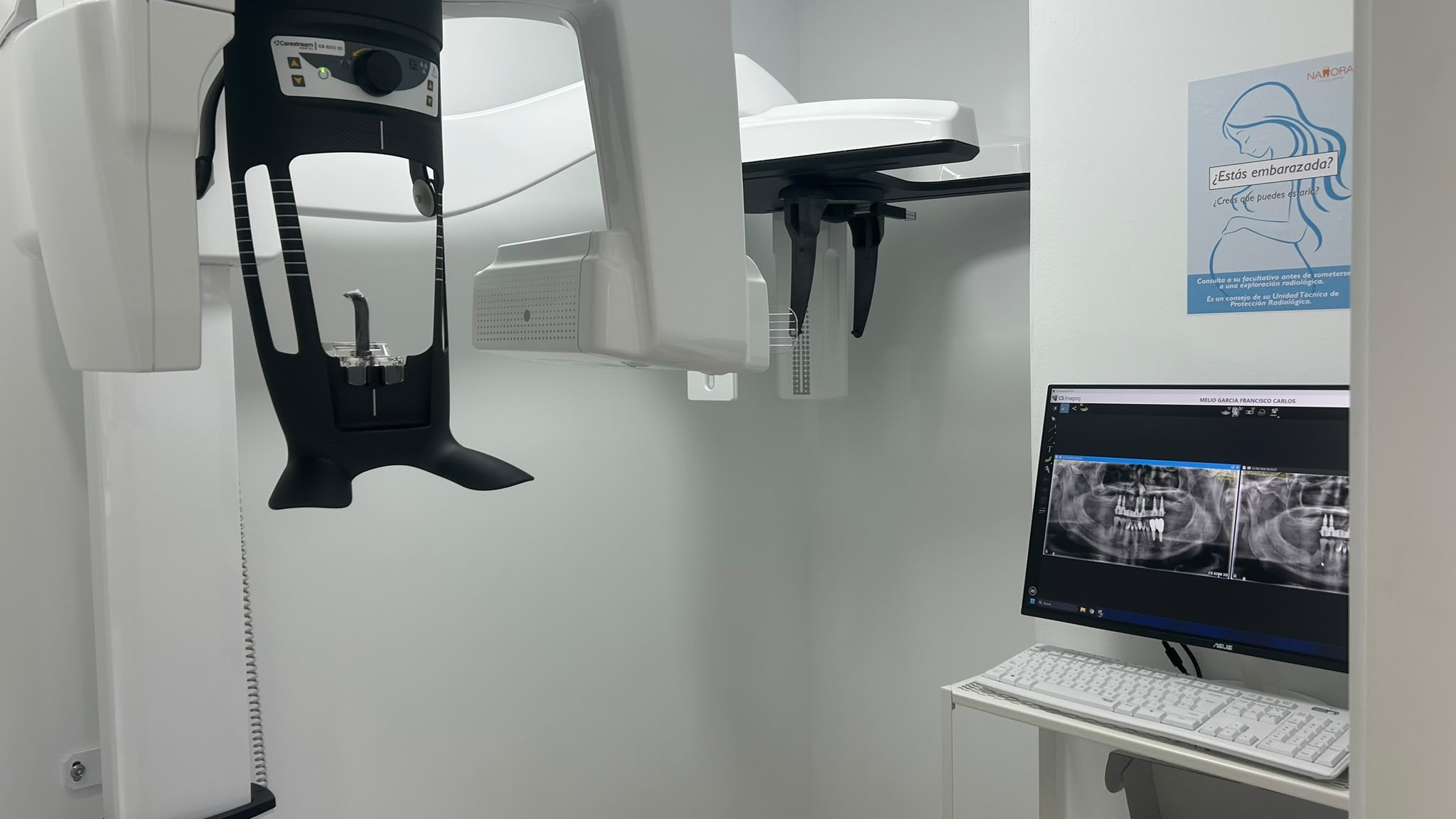 Escáner intraoral: qué aporta a un tratamiento dental moderno